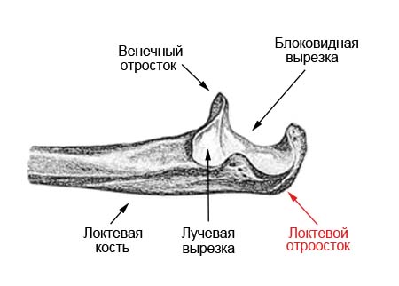 Перелом локтевого отростка классификация